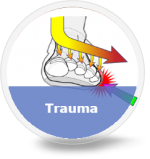 trauma-foot